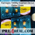 Kamagra 100Mg Examen De La Gelée Orale cialis5